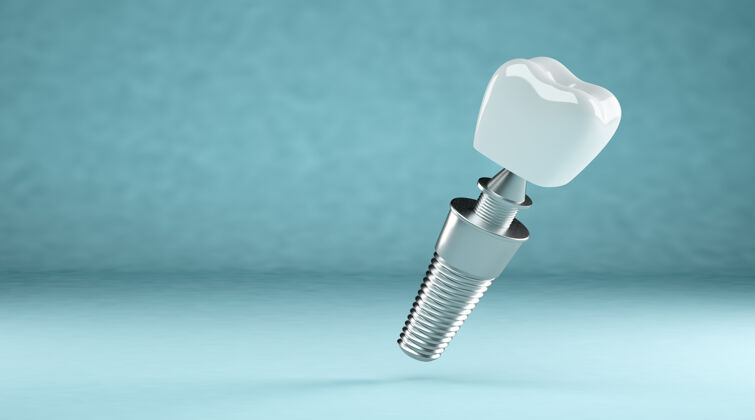 正畸医生牙齿植入 牙齿修复在三维渲染牙痛牙釉质牙齿