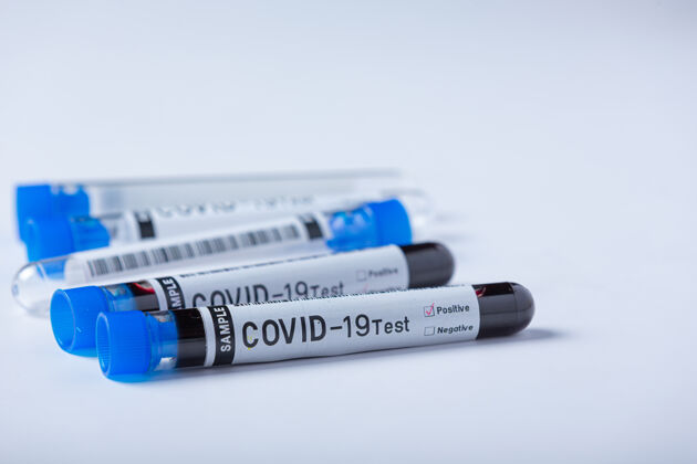 医院带血样的试管用于covid-19测试医学全球疫苗