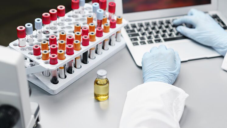 瓶子实验室里的女研究员拿着疫苗瓶和试管专家技术员知识分子