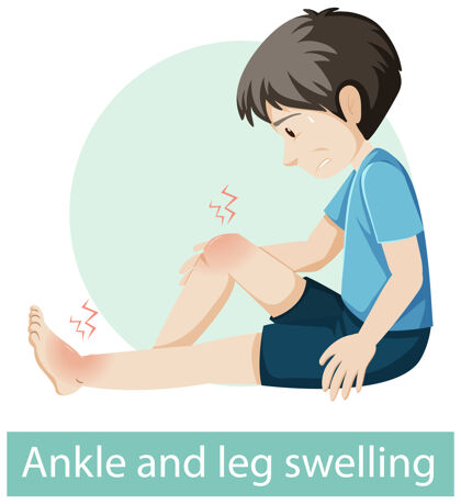 疼痛卡通人物有脚踝和腿部肿胀症状受伤疼痛剪贴画